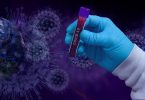Test buněčné imunity covid-19